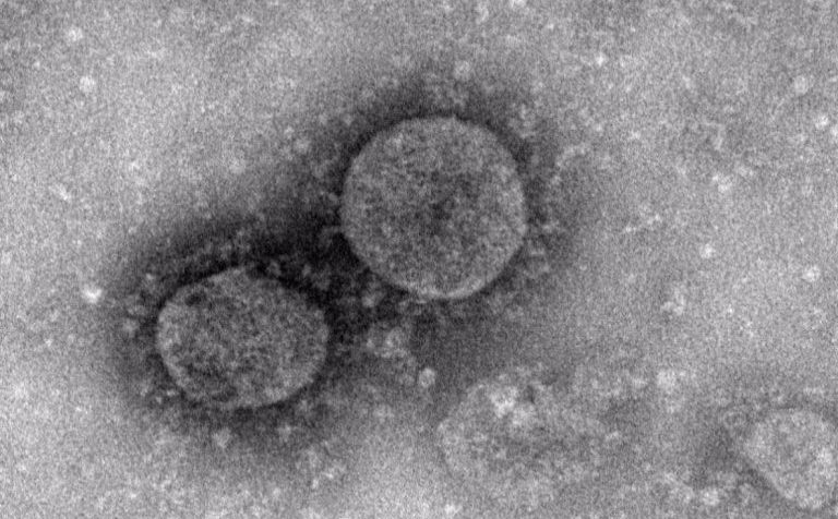 Что такое коронавирус 2019-nCoV и как нам жить дальше?