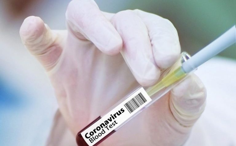 Учёные новосибирского научного центра «Вектор» завершили клинические исследования вакцины от COVID-19